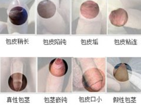 钦州桂大男科医院
