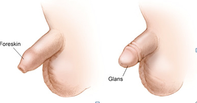 钦州九洲医院治疗包皮过长怎么样