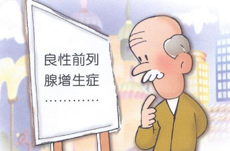 前列腺增生的症状有哪些