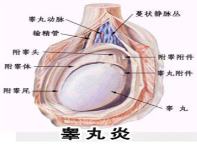 睾丸炎给男性带来哪些危害